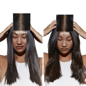 Kérastase Symbiose Bain Pureté Anti-Pelliculaire 250mL