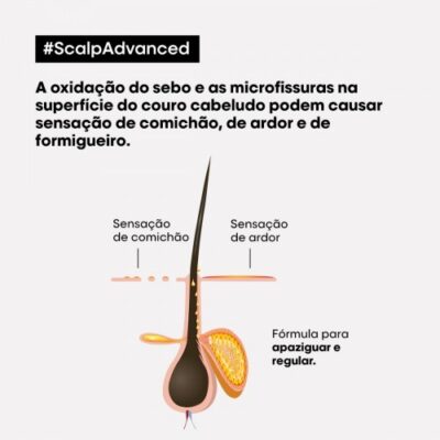 LOréal Scalp Advanced Anti-Discomfort Tratamento 200ml LOréal Scalp Advanced Anti-Discomfort Tratamento 200ml