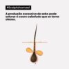 34636_1-500x500 L'Oréal Scalp Advanced Anti-Oiliness Shampoo 300ml