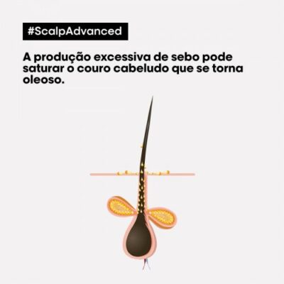 34636_1-500x500 L'Oréal Scalp Advanced Anti-Oiliness Shampoo 300ml