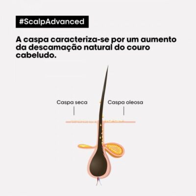 L'Oréal Scalp Advanced Anti-Dandruff Shampoo 300ml